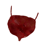 Опухоль мертвеца